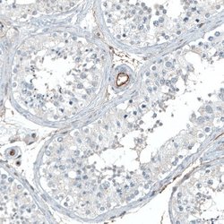 Integrin alpha 5/CD49e Antibody (CL6940), Novus Biologicals 25 &mu;L; Integrin